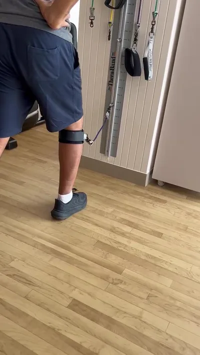 Knee Surgery Driving Timeline After ACL