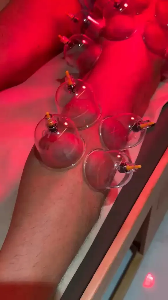 Dry cupping applied to the legs under an infrared lamp at Trivayu Physio Center, Vaishali Nagar